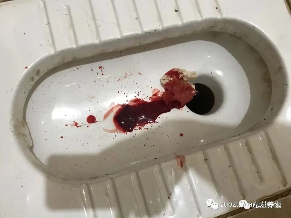 案例分享:子宫大出血调理案例 案例分享:子宫大出血调理案例