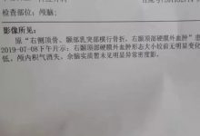 案例分享:车祸导致面瘫调理案例-七不姜 生姜养生网-明德CSA生态姜园&明安农业