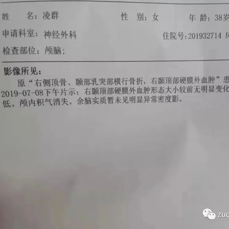 案例分享:车祸导致面瘫调理案例-七不姜 生姜养生网-明德CSA生态姜园&明安农业