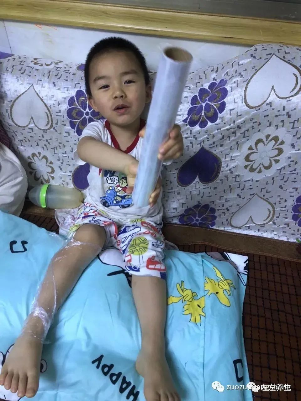 案例分享:三岁孩子右腿骨折调理案例 案例分享:三岁孩子右腿骨折调理案例