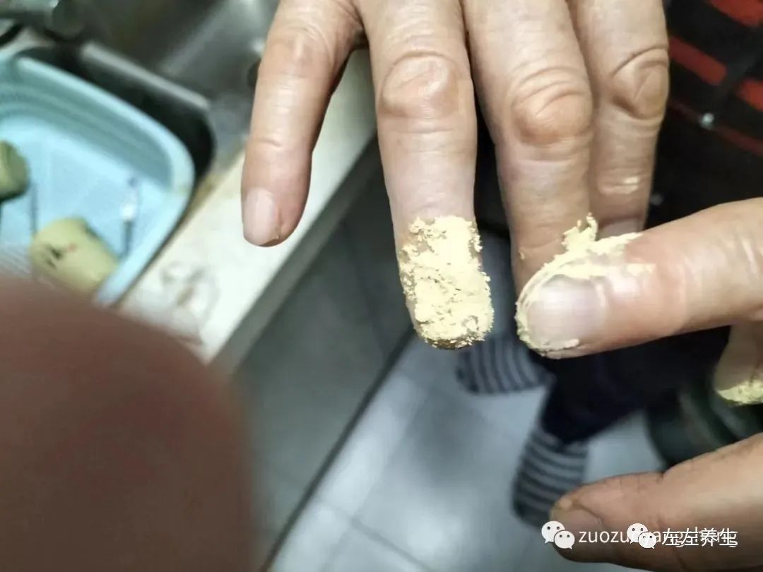 案例分享：手指夹伤后血流不止调理案例