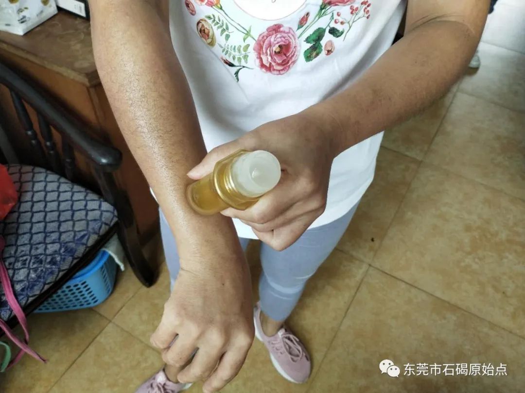 双手肿,胀痛,原始点调理3天康复 双手肿,胀痛,原始点调理3天康复