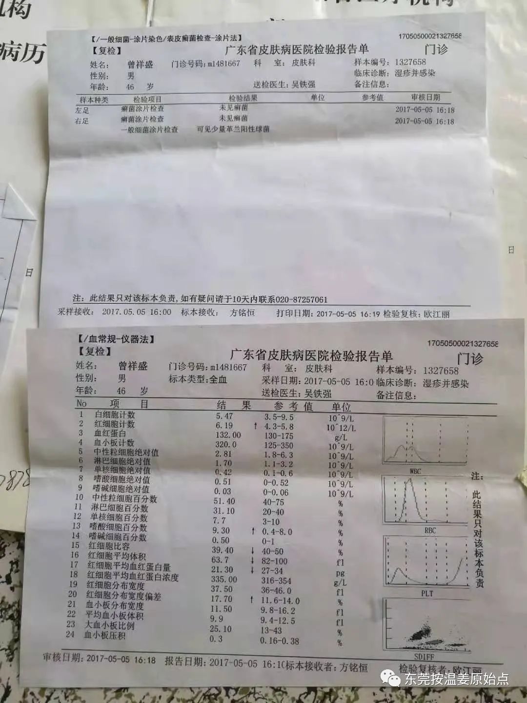 严重湿疹，真菌感染