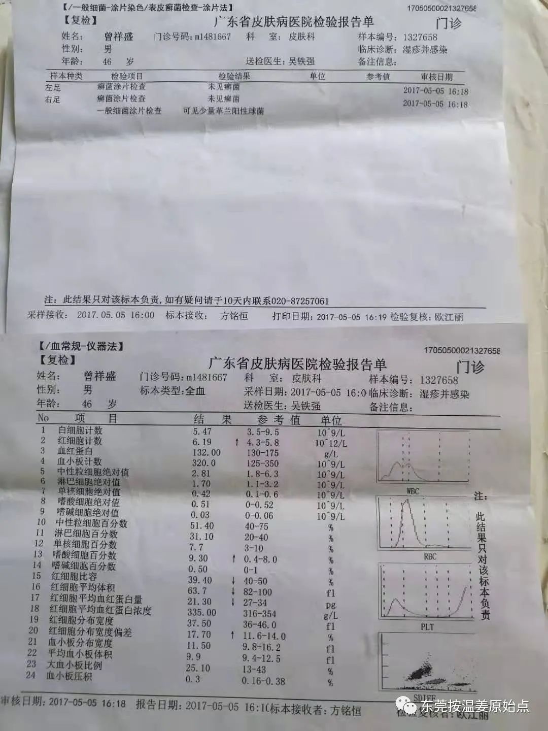 严重湿疹，真菌感染