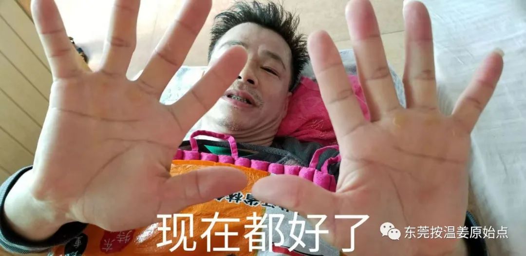 严重湿疹，真菌感染