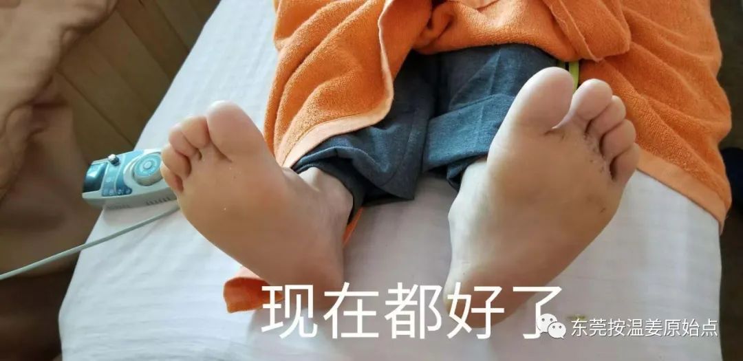 严重湿疹，真菌感染