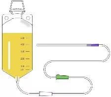 姜汤灌肠、姜粉泥灌肠、姜粉灌肠步骤（2020年更新版）
