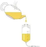 姜汤灌肠、姜粉泥灌肠、姜粉灌肠步骤（2020年更新版）