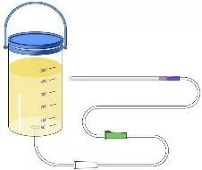 姜汤灌肠、姜粉泥灌肠、姜粉灌肠步骤（2020年更新版）