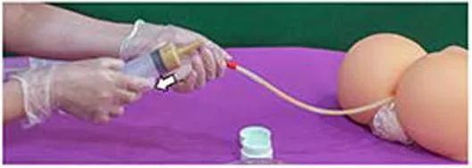 姜汤灌肠、姜粉泥灌肠、姜粉灌肠步骤（2020年更新版）