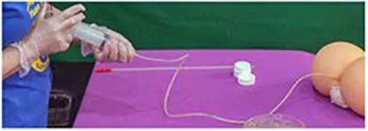 姜汤灌肠、姜粉泥灌肠、姜粉灌肠步骤（2020年更新版）