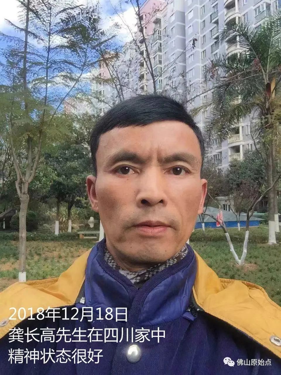 原始点调理浆细胞型巨大淋巴结增生病(CastIeman病)案例 原始点调理浆细胞型巨大淋巴结增生病(CastIeman病)案例