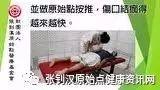 车祸烧伤案例(广西)-七不姜 生姜养生网-明德CSA生态姜园&明安农业