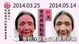 干癣案例(杨女士脸皮肤红肿)-七不姜 生姜养生网-明德CSA生态姜园&明安农业