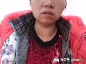 两个肿瘤案例对比背后的深思 两个肿瘤案例对比背后的深思