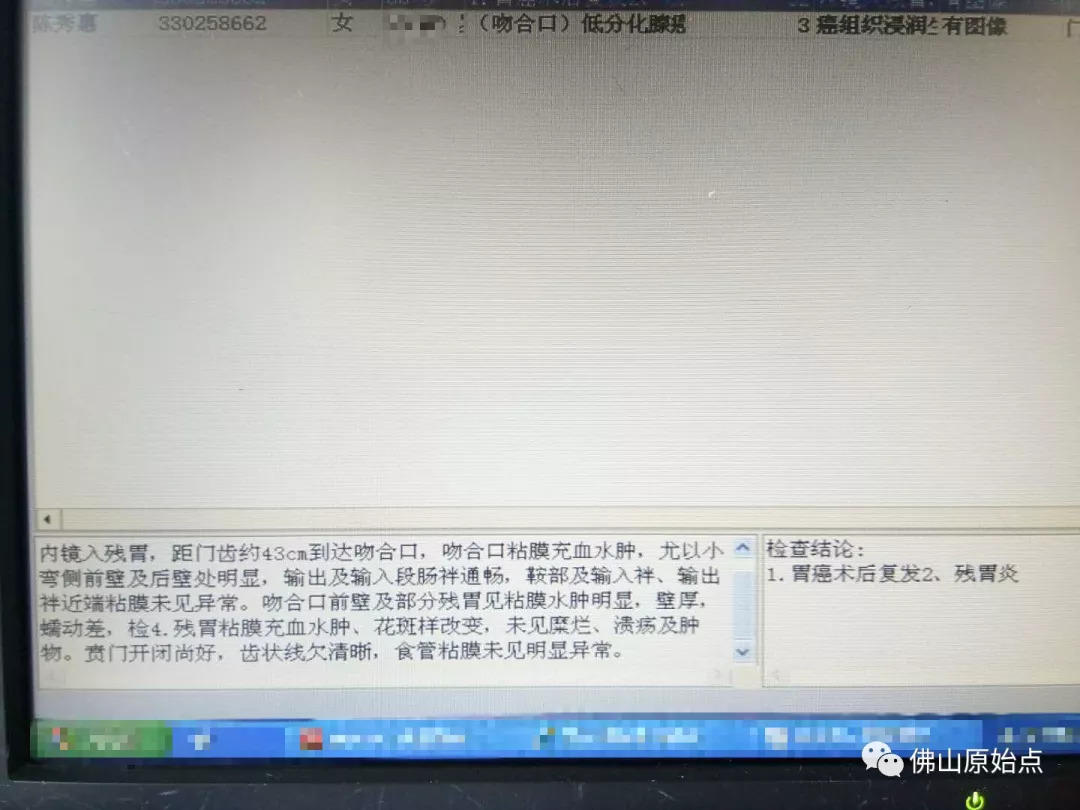 胃癌术后复发,原始点调理两个多月后完全解症 胃癌术后复发,原始点调理两个多月后完全解症