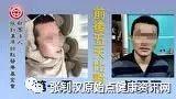 发烧四十度案例-七不姜 生姜养生网-明德CSA生态姜园&明安农业