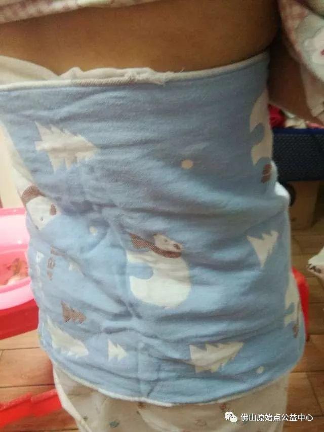 原始点调理带状疱疹：12天恢复+意外收获