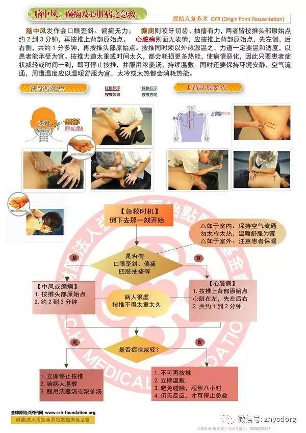 脑中风、癫痫、心脏病之院前急救。原始点复苏术 OPR (Origin Point Resuscitation)