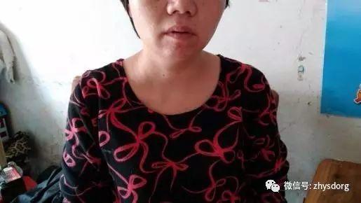 两个肿瘤案例对比背后的深思 两个肿瘤案例对比背后的深思