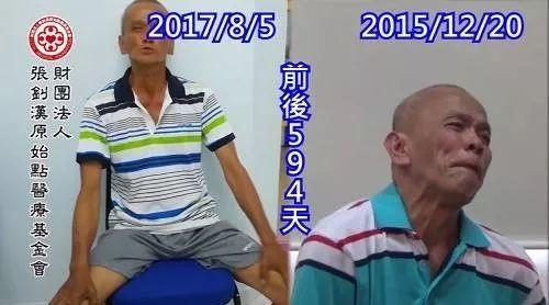 梅杰综合症案例--2017.10最新案例-七不姜 生姜养生网-明德CSA生态姜园&明安农业