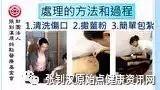 硫酸灼伤案例-七不姜 生姜养生网-明德CSA生态姜园&明安农业
