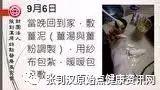 手臂烫伤案例(山东)-七不姜 生姜养生网-明德CSA生态姜园&明安农业