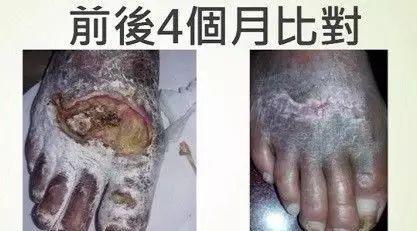 毒蛇咬伤如何处理-2017.1太原讲座剪辑-七不姜 生姜养生网-明德CSA生态姜园&明安农业