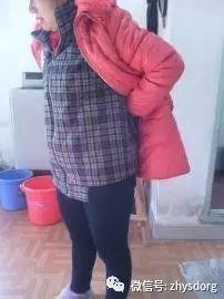 两个肿瘤案例对比背后的深思 两个肿瘤案例对比背后的深思