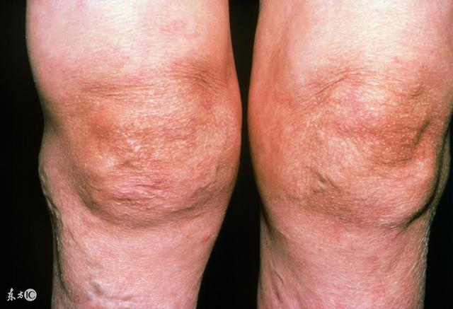 巧用生姜治百病，生姜的妙用，让你懂得怎么吃生姜