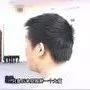 全身24小时痒案例(简体版)-七不姜 生姜养生网-明德CSA生态姜园&明安农业