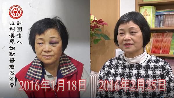 车祸头部外伤出血案例（简体版）-七不姜 生姜养生网-明德CSA生态姜园&明安农业