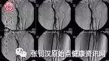 黑脚阿妈案例-七不姜 生姜养生网-明德CSA生态姜园&明安农业