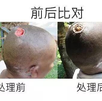 头部溃烂案例(简体版)-七不姜 生姜养生网-明德CSA生态姜园&明安农业