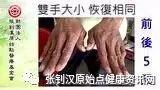 虎头蜂蛰伤案例-最新2017版案例-七不姜 生姜养生网-明德CSA生态姜园&明安农业