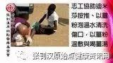 足部潰爛案例(辛巴威)-最新2017版案例-七不姜 生姜养生网-明德CSA生态姜园&明安农业