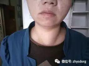 两个肿瘤案例对比背后的深思 两个肿瘤案例对比背后的深思