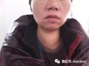 两个肿瘤案例对比背后的深思 两个肿瘤案例对比背后的深思