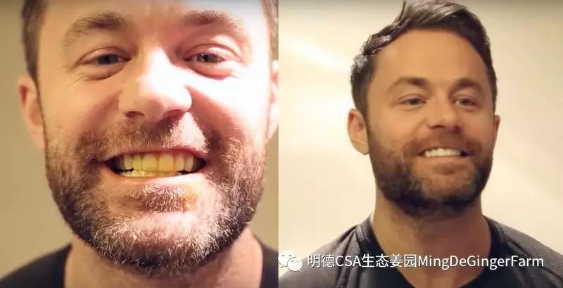 美牙神器-七不姜 生姜养生网-明德CSA生态姜园&明安农业