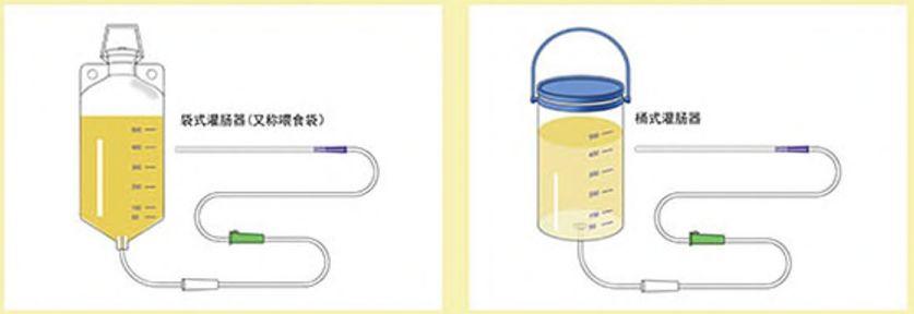 原始点姜汤灌肠工具介绍及步骤详解 原始点姜汤灌肠工具介绍及步骤详解