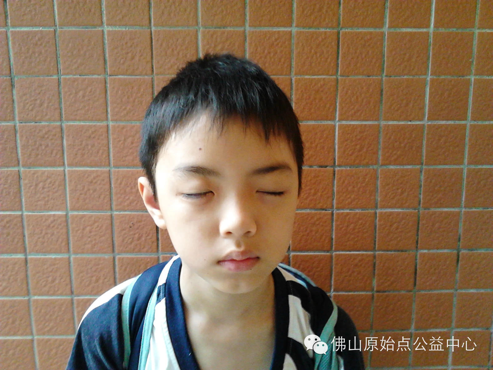 用原始点理疗病毒性脑炎后遗症三个月好了一大半 用原始点理疗病毒性脑炎后遗症三个月好了一大半