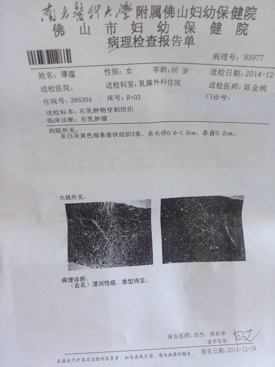 原始点调理乳腺癌三个月基本康复 原始点调理乳腺癌三个月基本康复