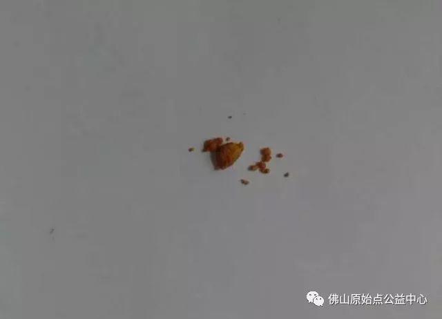 本中心学员花开深圳,原始点调理,先后自然排出肾结石 本中心学员花开深圳,原始点调理,先后自然排出肾结石