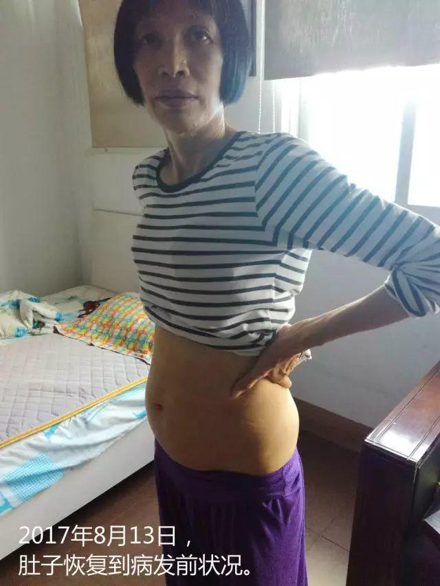 原始点调理腹水双下肢水肿:清晰的观念+信心 成就健康 原始点调理腹水双下肢水肿:清晰的观念+信心 成就健康