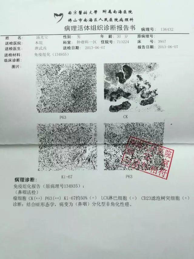原始点调理鼻咽癌三期放化疗后遗症:细节决定效果 原始点调理鼻咽癌三期放化疗后遗症:细节决定效果