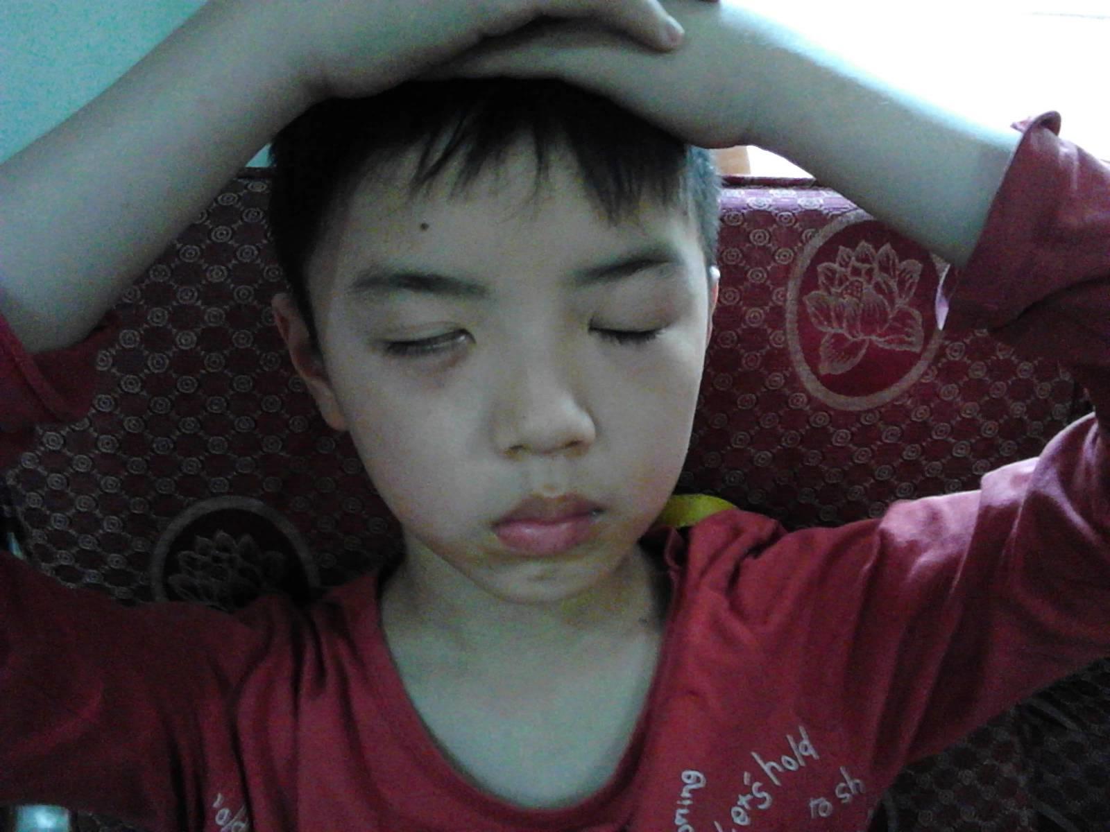 用原始点理疗病毒性脑炎后遗症三个月好了一大半 用原始点理疗病毒性脑炎后遗症三个月好了一大半