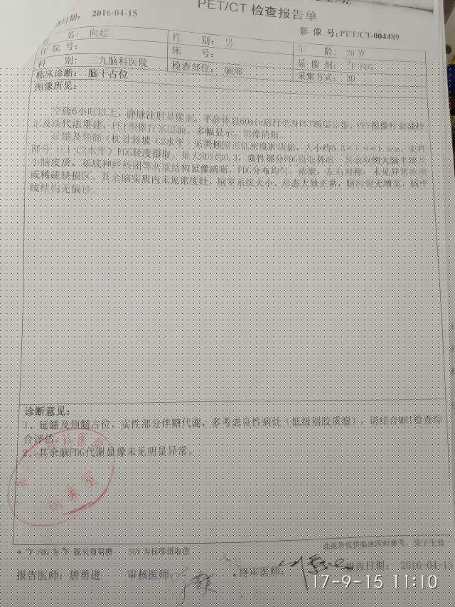 原始点调理脑胶质瘤:告别风雨见阳光 原始点调理脑胶质瘤:告别风雨见阳光