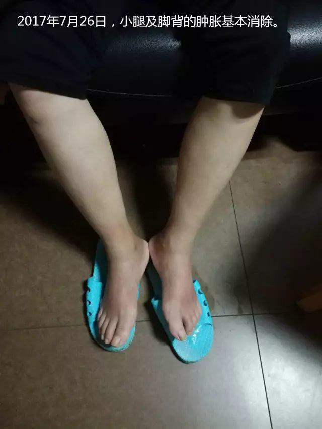 原始点调理腹水双下肢水肿:清晰的观念+信心 成就健康 原始点调理腹水双下肢水肿:清晰的观念+信心 成就健康