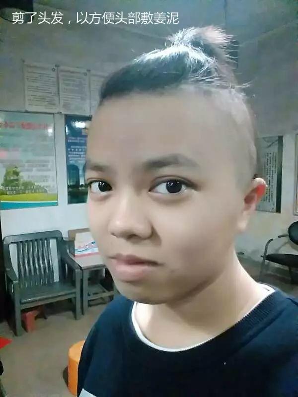 原始点调理中脑管口狭窄脑积水：65天，从黑暗到光明