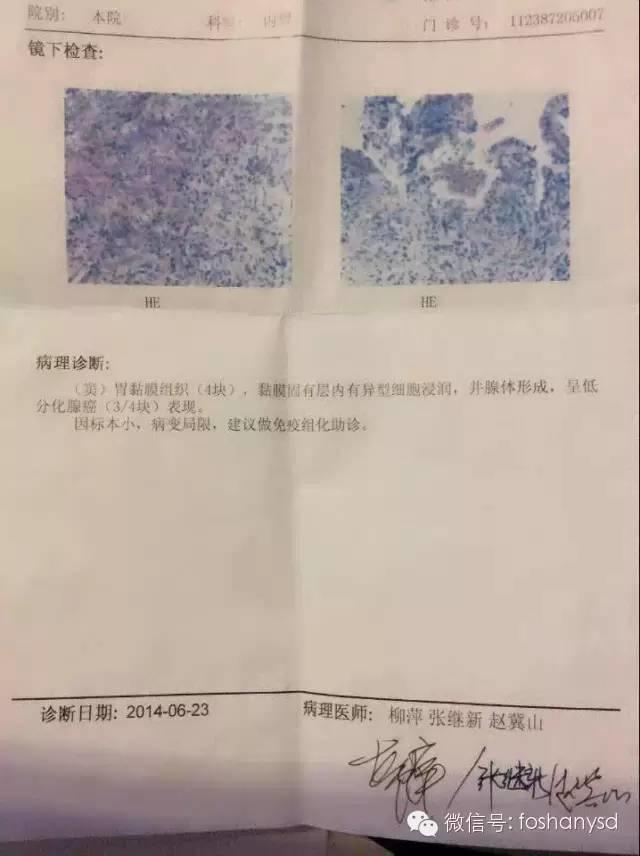 北京原始点中心案例 | 丛女士自述胃癌案例 北京原始点中心案例 | 丛女士自述胃癌案例